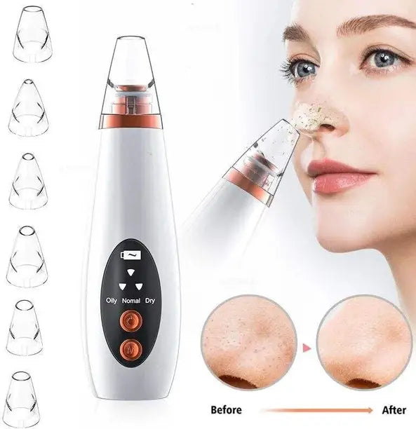6 in 1 multifunctional blackhead remover