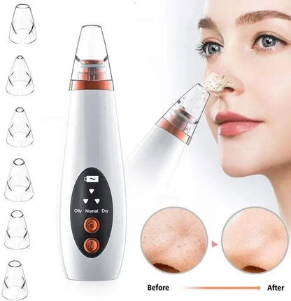 6 in 1 multifunctional blackhead remover
